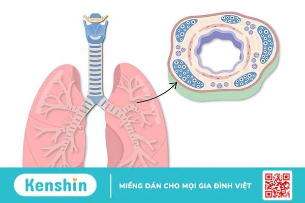 Tìm hiểu ngay về cấu tạo, chức năng và cách bảo vệ phế quản 3