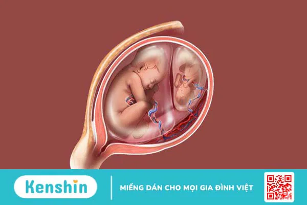 Phôi xấu có đậu thai không? Xử lý thế nào?