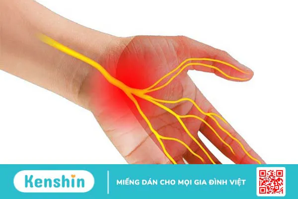 Phục hồi chức năng tổn thương thần kinh giữa