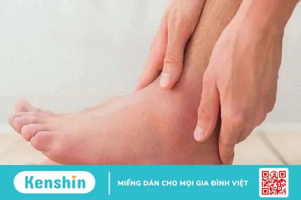 Phương pháp điều trị bệnh mắt cá chân