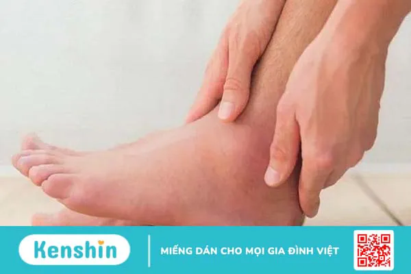 Phương pháp điều trị bệnh mắt cá chân