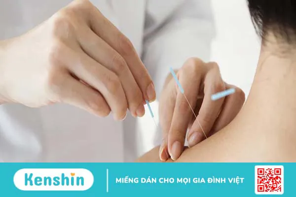 Phương pháp Đông y châm cứu viêm quanh khớp vai