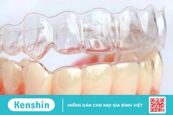 Phương pháp niềng răng tháo lắp là gì? Niềng răng tháo lắp có thật sự hiệu quả không? 4