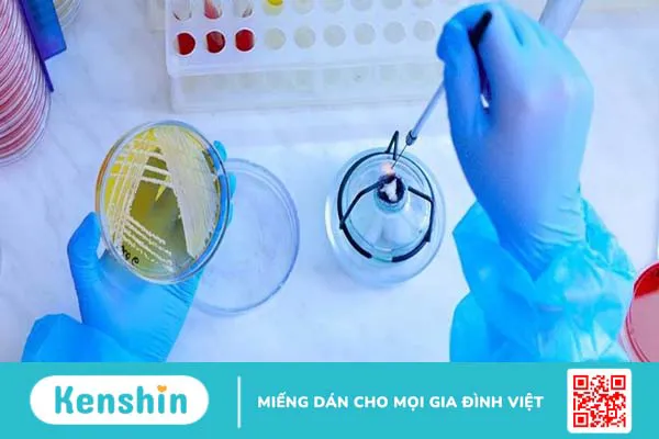 Phương pháp phân lập vi sinh vật và những điều cần biết 3