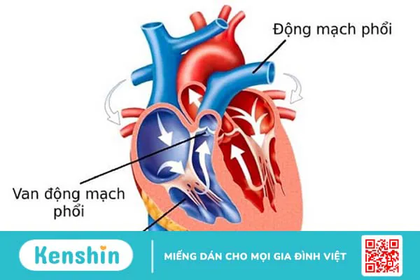 Phương pháp phẫu thuật điều trị tĩnh mạch phổi đổ lệch chỗ bán phần 1