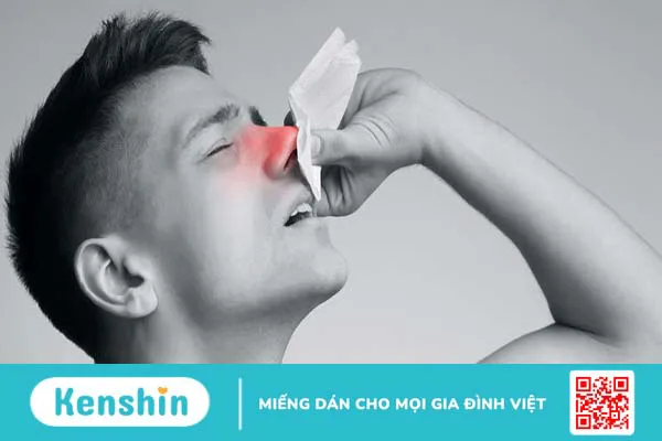 Polyp mũi có nguy hiểm không? Những điều cần biết về Polyp mũi