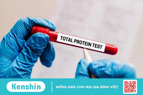 Protein toàn phần là gì? Những điều cần biết về xét nghiệm protein toàn phần