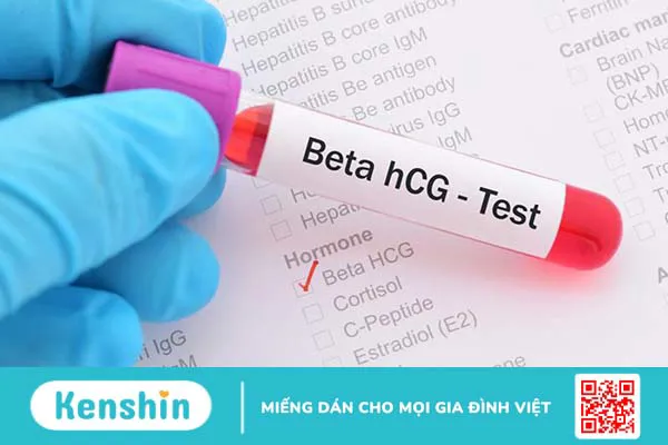 Que thử thai 2 vạch đậm là mang thai hay không?