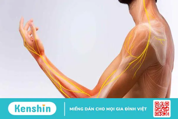 Quy trình khám cơ lực giúp đánh giá, định hướng nguyên nhân gây liệt ở người bệnh