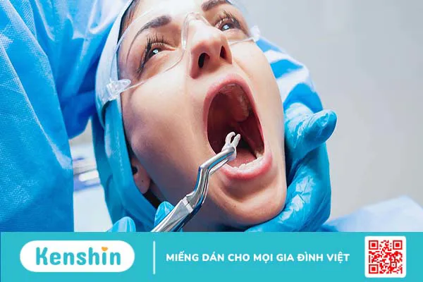 Quy trình nhổ răng khôn được tiến hành như thế nào? Cần lưu ý điều gì?