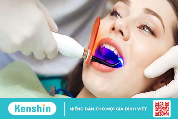 Quy trình tẩy trắng răng bằng phương pháp laser hiện nay