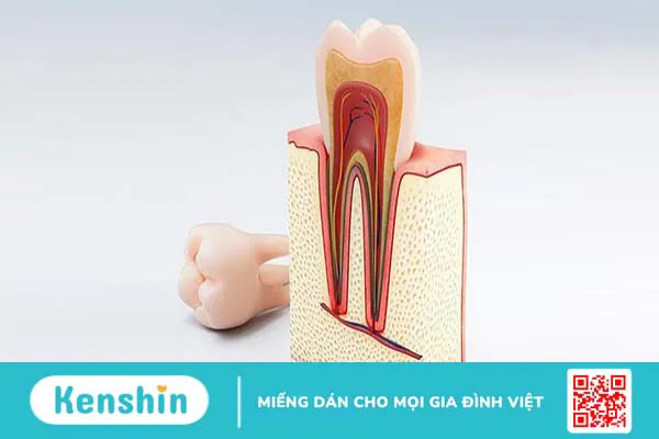 Quy trình thực hiện điều trị tủy răng bằng máy