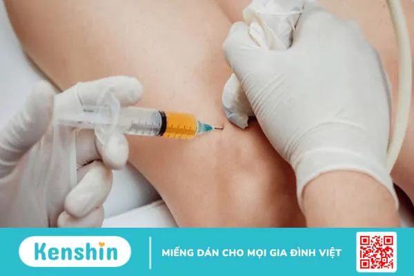 Quy trình thực hiện hút dịch khớp gối