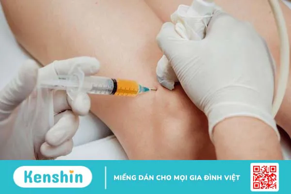 Quy trình thực hiện hút dịch khớp gối