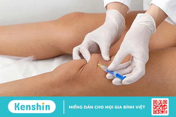 Quy trình thực hiện hút dịch khớp gối