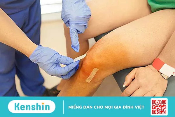 Quy trình thực hiện hút dịch khớp gối