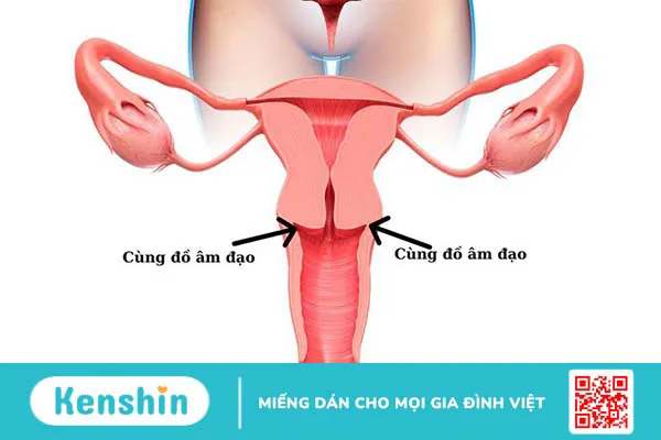 Rách cùng đồ âm đạo: Nguyên nhân, triệu chứng, cách điều trị