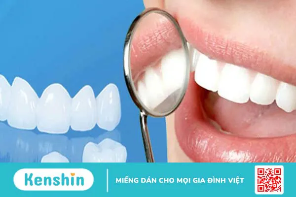 Răng sứ ceramill có mấy loại? Răng sứ ceramill có tốt không? 2