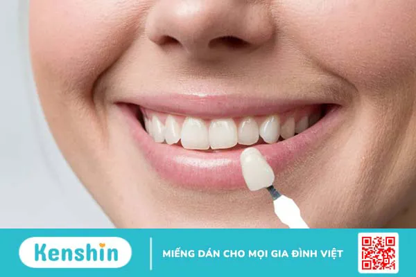 Răng sứ HT Smile là gì? Có tốt không? Ưu điểm của răng sứ HT Smile