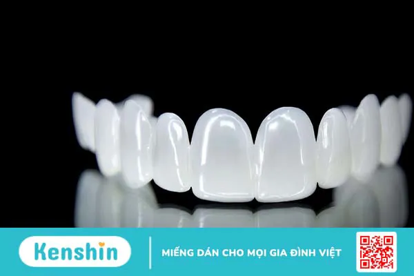 Răng sứ HT Smile là gì? Có tốt không? Ưu điểm của răng sứ HT Smile