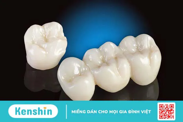 Răng sứ nacera có bền không? Cần lưu ý gì? 2