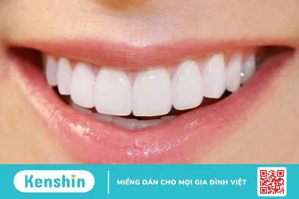 Răng sứ nacera có bền không? Cần lưu ý gì? 3