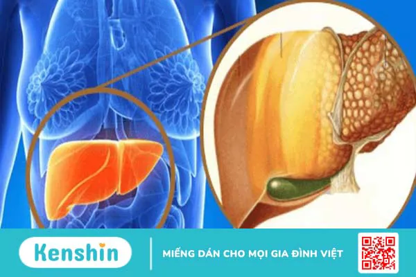 Rối loạn chuyển hóa là gì? Hiểu đúng để điều trị và phòng tránh hiệu quả 3