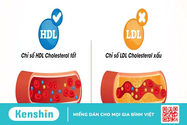 Rối loạn mỡ máu là gì? Nguyên nhân dẫn đến rối loạn mỡ máu