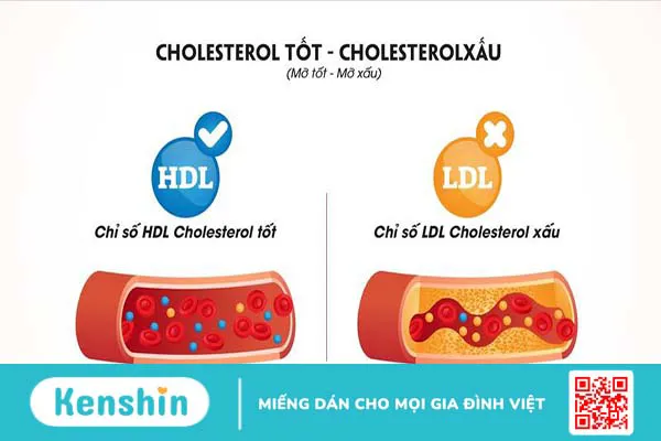 Rối loạn mỡ máu là gì? Nguyên nhân dẫn đến rối loạn mỡ máu