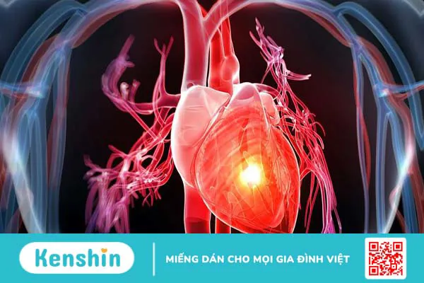 Rối loạn nhịp tim nhanh trên thất: Nguyên nhân và cách điều trị hiệu quả