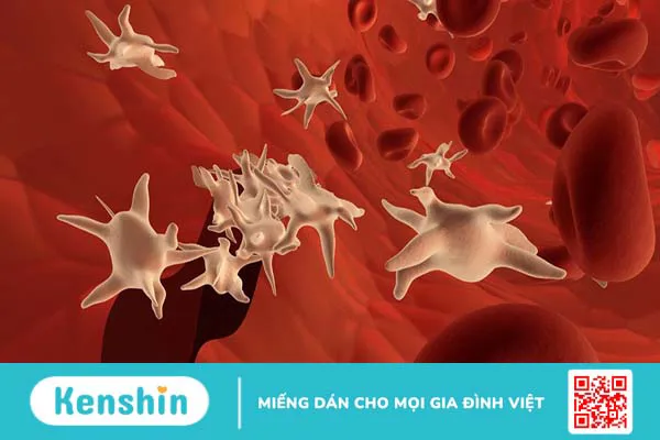 Rối loạn tế bào máu là gì? Triệu chứng và phân loại rối loạn tế bào máu