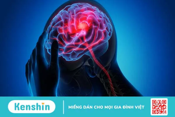 Rối loạn thần kinh: Hiểu rõ hơn về căn bệnh để có biện pháp phòng ngừa