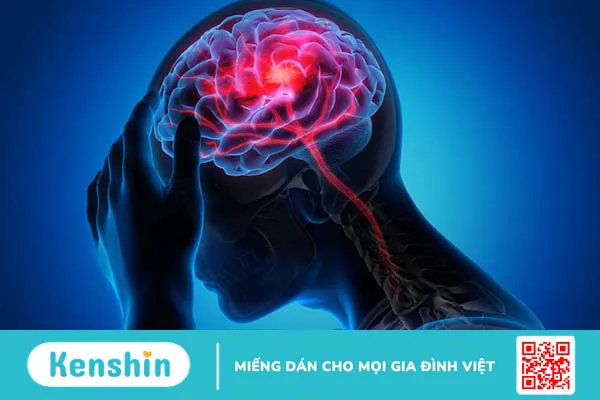 Rối loạn thần kinh: Hiểu rõ hơn về căn bệnh để có biện pháp phòng ngừa