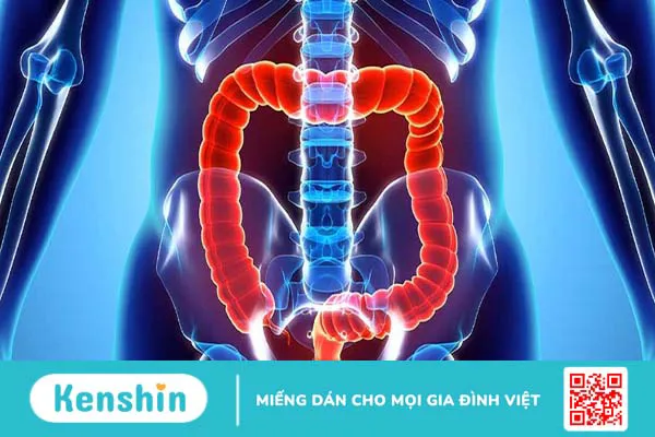 Sa trực tràng và trĩ có giống nhau không? Cách phân biệt