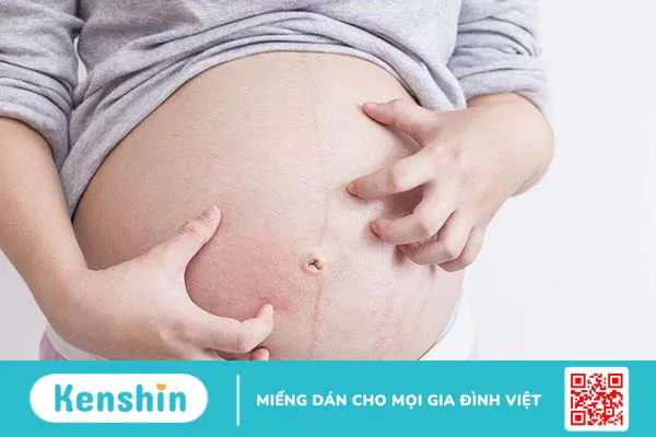 Sẩn ngứa: Nguyên nhân, dấu hiệu và phương pháp điều trị