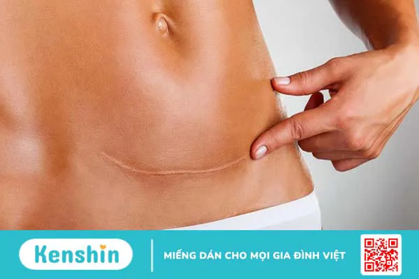 Sau đẻ mổ 4 tháng lại có bầu phải làm thế nào? Những biểu hiện mẹ bầu cần chú ý