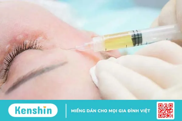 Sau khi làm PRP kiêng gì là tốt nhất?