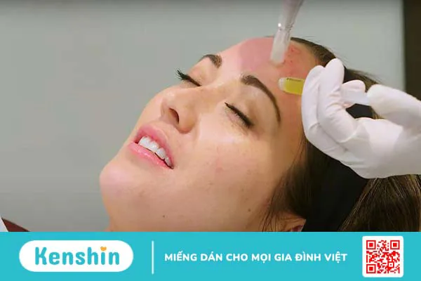 Sau làm PRP kiêng gì là tốt nhất? 1