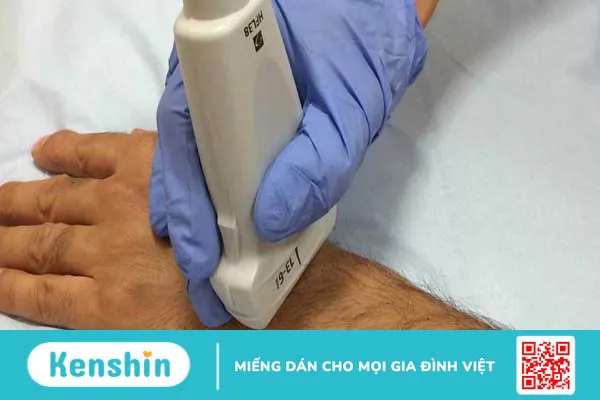 Siêu âm khớp cổ tay hỗ trợ chẩn đoán những bệnh lý gì?