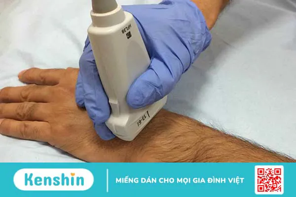 Siêu âm khớp cổ tay hỗ trợ chẩn đoán những bệnh lý gì? 1