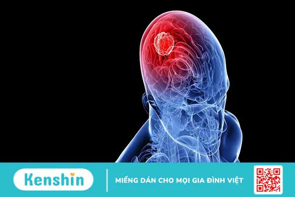 Sinh thiết não là gì? Có nguy hiểm không?