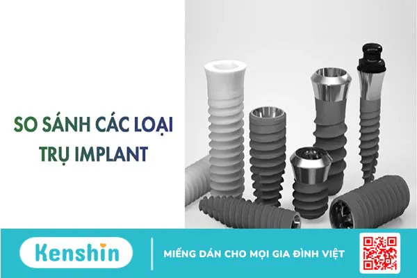 So sánh các loại trụ Implant phổ biến hiện nay