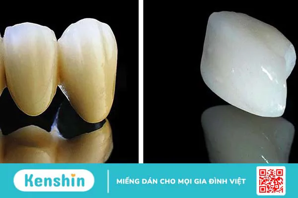 So sánh răng sứ kim loại và răng toàn sứ