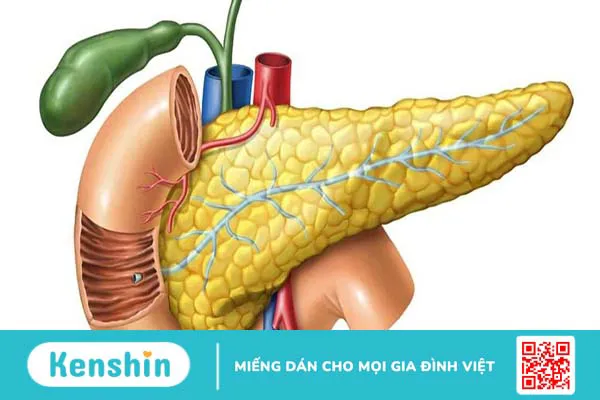 Sỏi tụy có nguy hiểm không? Biểu hiện của sỏi tụy là gì?