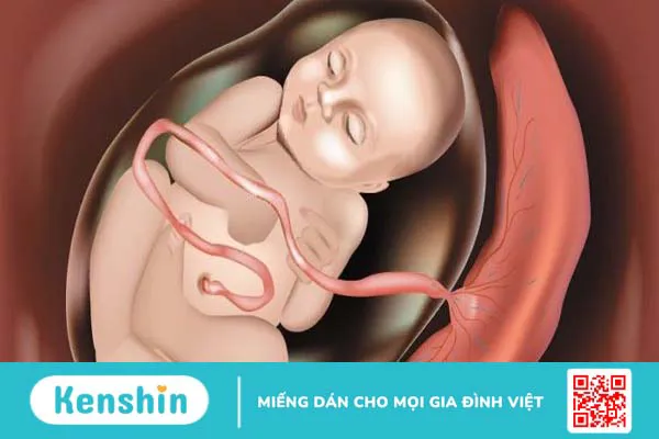 Sót nhau sau sinh: Nguyên nhân, triệu chứng, điều trị và cách phòng ngừa