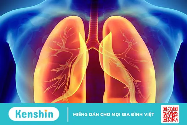 Sốt xuất huyết tràn dịch màng phổi có nguy hiểm không?