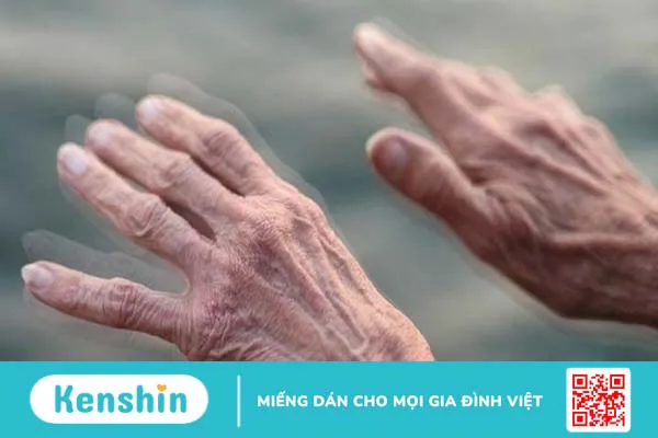 Sự cô đơn ảnh hưởng như thế nào tới bệnh Parkinson?