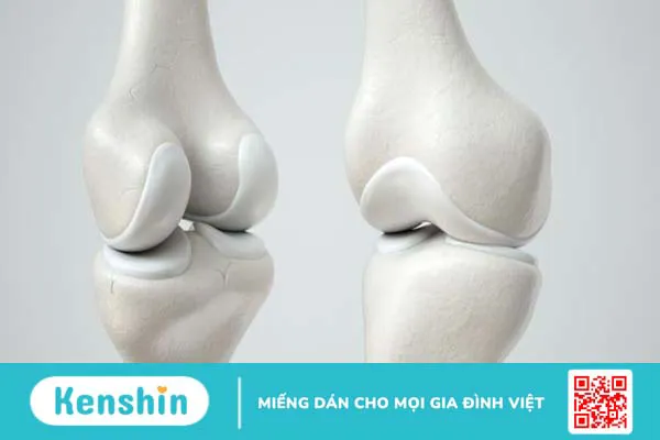 Sụn xương là gì? Tầm quan trọng của sụn xương đối với cơ thể