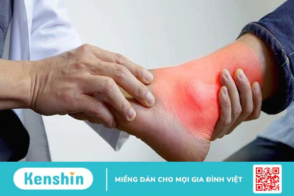 Sưng mắt cá chân khi mang thai: Nguyên nhân, triệu chứng, cách điều trị và phòng ngừa