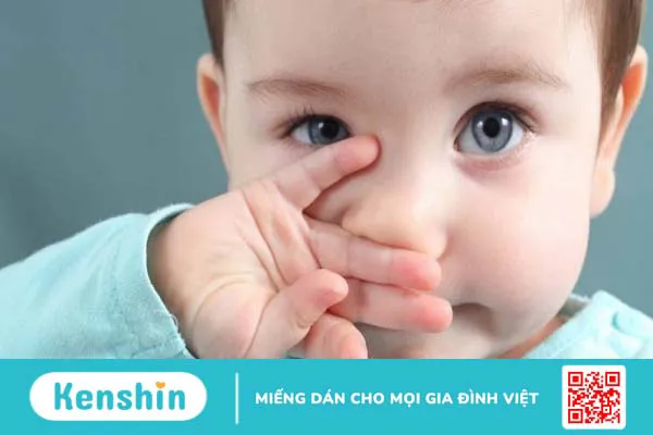 Sụp mí bẩm sinh: Nguyên nhân, biểu hiện nhận biết các cách điều trị bệnh hiệu quả 2